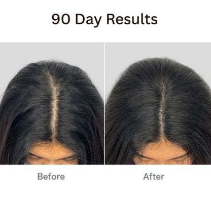 𝗧𝗵𝗲𝗿𝗮𝗕𝗿𝘂𝘀𝗵™ 𝗧𝗵𝗲 𝗡𝗮𝘁𝘂𝗿𝗮𝗹 𝟰𝗶𝗻𝟭 𝗛𝗮𝗶𝗿 with hair Tonic
