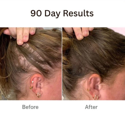 𝗧𝗵𝗲𝗿𝗮𝗕𝗿𝘂𝘀𝗵™ 𝗧𝗵𝗲 𝗡𝗮𝘁𝘂𝗿𝗮𝗹 𝟰𝗶𝗻𝟭 𝗛𝗮𝗶𝗿 with hair Tonic
