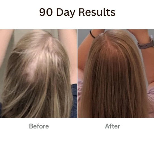 𝗧𝗵𝗲𝗿𝗮𝗕𝗿𝘂𝘀𝗵™ 𝗧𝗵𝗲 𝗡𝗮𝘁𝘂𝗿𝗮𝗹 𝟰𝗶𝗻𝟭 𝗛𝗮𝗶𝗿 with hair Tonic